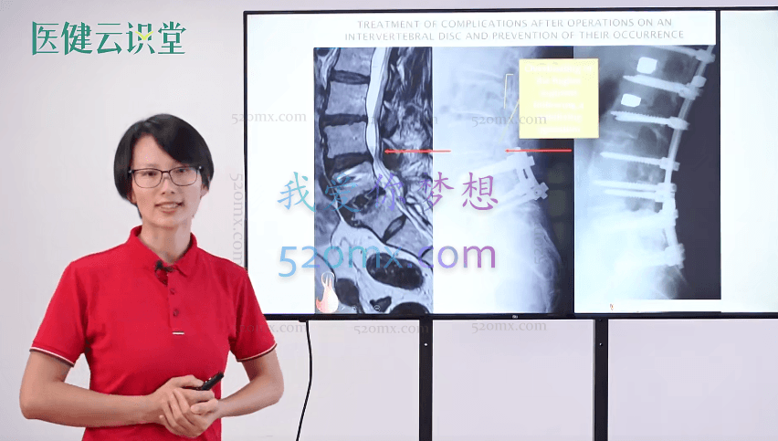 【陈冬凤】SPS螺旋稳定肌肉链技术高效处理腰痛、腰椎间盘突出